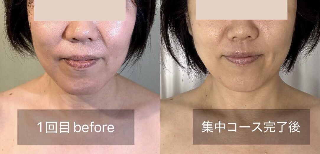 集中コース完了後のビフォーアフター