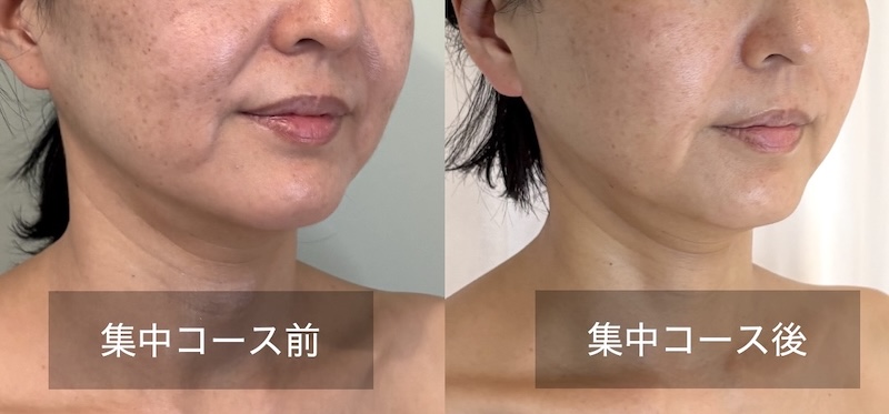 集中コース前と後のビフォーアフター