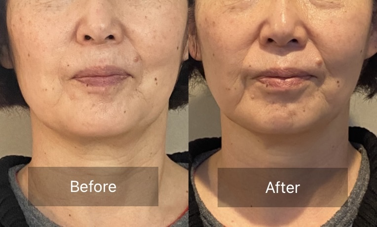 45分コース1回の変化の写真