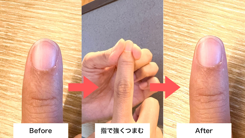 指先を強い力でつまんだ時の指の形の変化