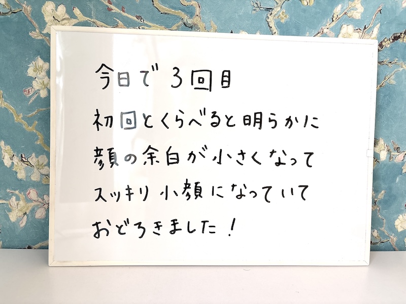 お客様の感想ホワイトボード「今日で3回目
初回とくらべると明らかに顔の余白が小さくなってスッキリ小顔になっていておどろきました!」