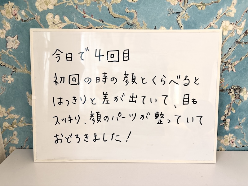 今日で4回目
初回の時の顔とくらべるとはっきりと差が出ていて、目もスッキリ、顔のパーツが整っていておどろきました!