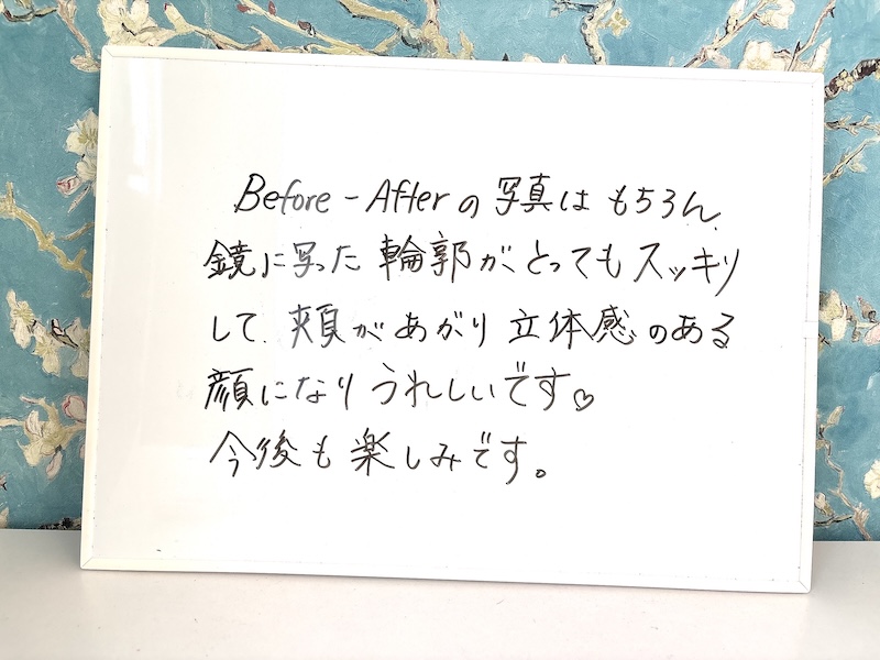 お客様の感想:Before-Aferの写真はもちろん、鏡に写った輸が、とってもスッキリして、頬があがり立体感のある顔になりうれしいです。今後も楽しみです。
