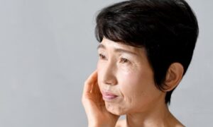 たるみに悩む女性