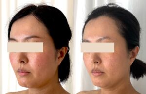 1回目と5回目のビフォーアフター