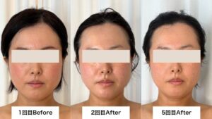 1、2、5回目の変化