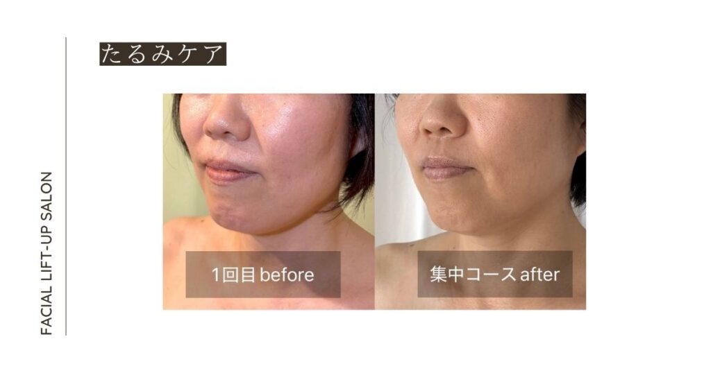 ブログアイキャッチ