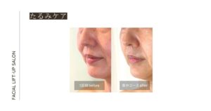 ブログアイキャッチ