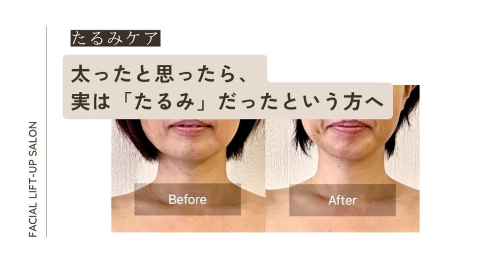 太ったと思ったら実は「たるみ」だった