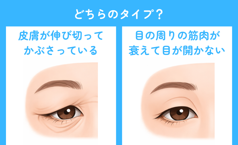 まぶたのたるみアイキャッチ