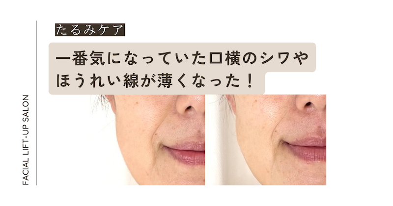 ブログアイキャッチ