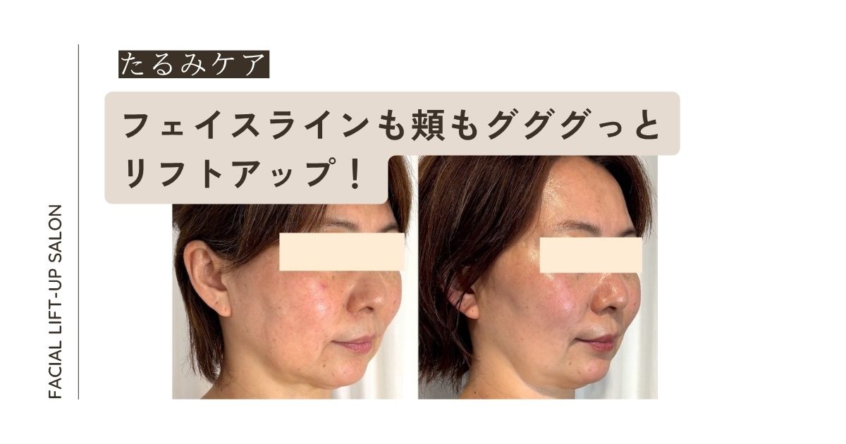 ブログアイキャッチ画像