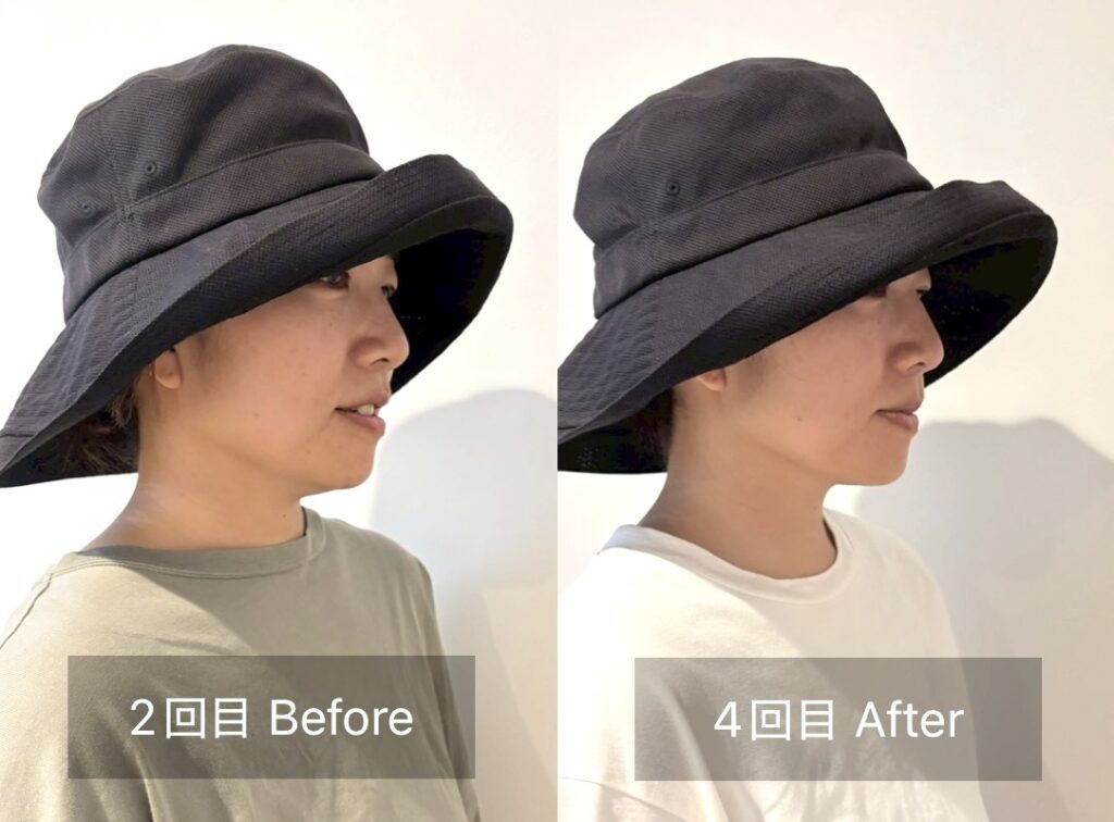 帽子をかぶったビフォーアフター