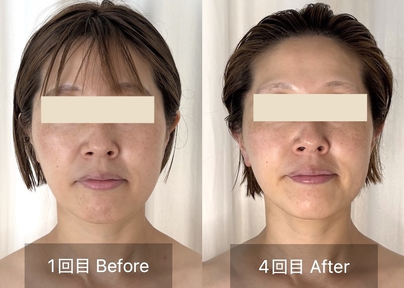 1回目と4回目のビフォーアフター写真