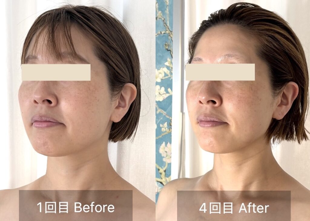 1回目と4回目の左側のお顔の変化