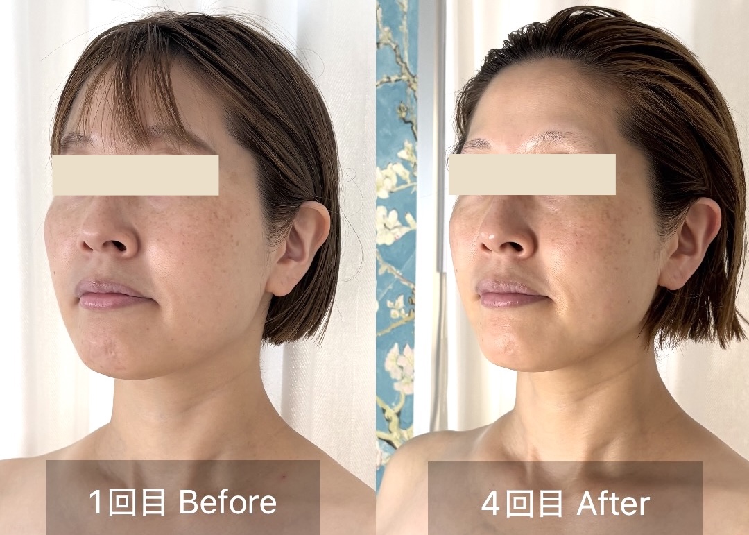 1回目と4回目の左側のお顔の変化
