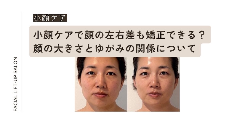 小顔ケアで顔の左右差も矯正できる？顔の大きさとゆがみの関係について