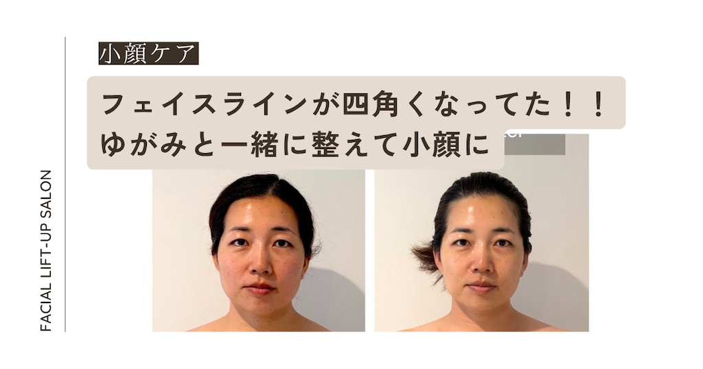 フェイスラインが四角くなってた!! ゆがみと一緒に整えて小顔にーアイキャッチ画像ー