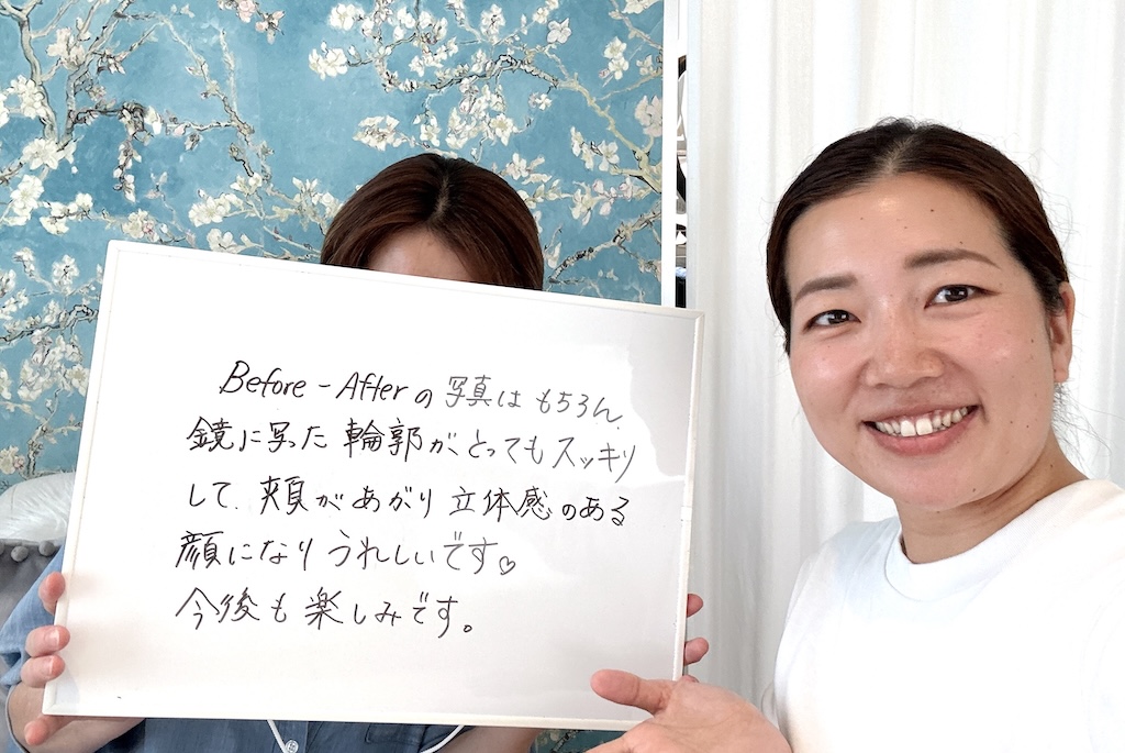 お客様の感想：Before-Aferの写真はもちろん、鏡に写った輸が、とってもスッキリして、頬があがり立体感のある顔になりうれしいです。今後も楽しみです。